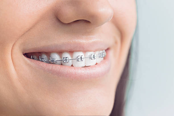 Best Invisalign and Clear Aligners  in Elkhart, IN